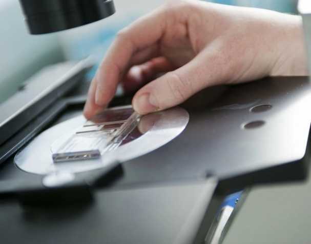 SAMe或成慢性结肠炎新希望？