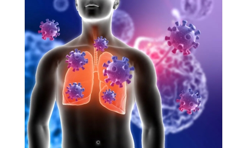 钟南山：6月底将迎来二阳高峰！危害更大？NMN能有效抵御“二阳”！